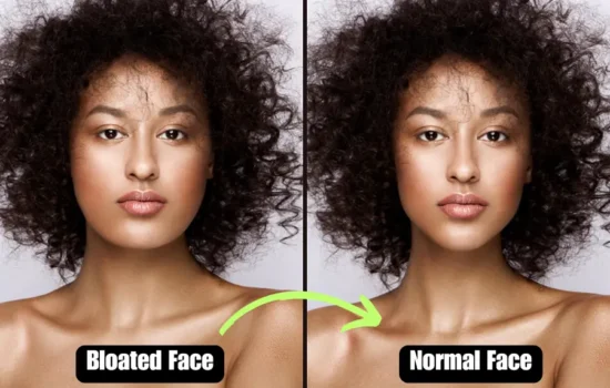 rid of bloated face